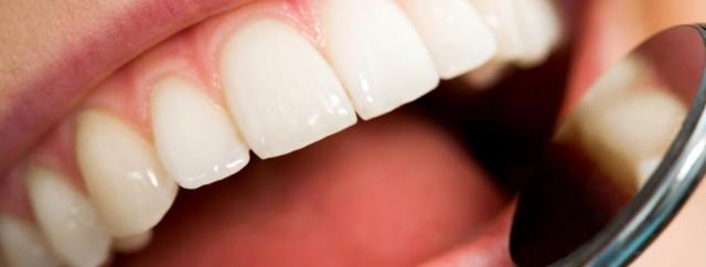 Estética Dental - Dental HD