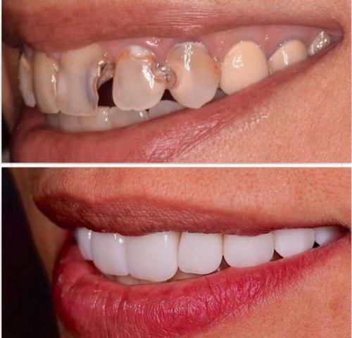 Dental HD (Tratamientos de Belleza)
